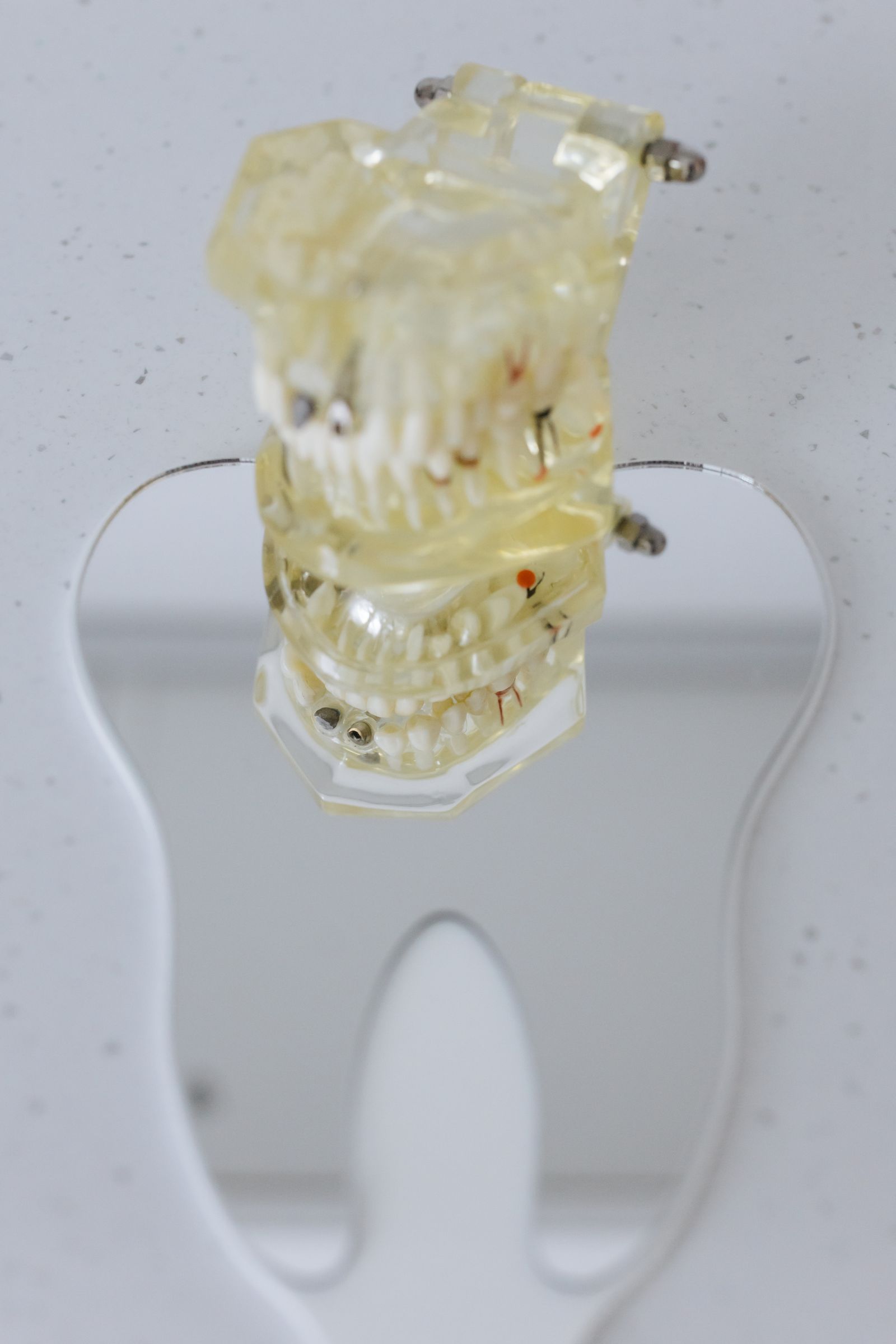 Clear aligner model on a stand